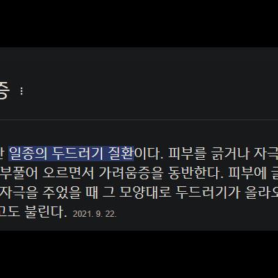 희귀병을 예술로 승화한 모델